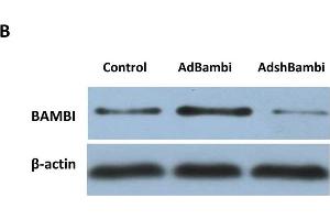 TLR4-dependent downregulation of BAMBI enhances the intensity of TGF-β-mediated EMT responses. (BAMBI anticorps  (AA 101-200))