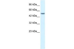 WB Suggested Anti-ANKRD11 Antibody Titration:  1. (ANKRD11 anticorps  (N-Term))