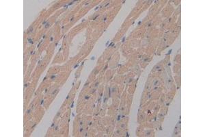 Used in DAB staining on fromalin fixed paraffin- embedded Kidney tissue