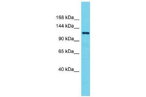 Host:  Rabbit  Target Name:  Hdac7  Sample Type:  Rat Spleen lysates  Antibody Dilution:  1. (HDAC7 anticorps  (N-Term))