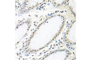 Immunohistochemistry of paraffin-embedded human stomach using ELAVL1 antibody. (ELAVL1 anticorps)