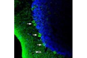 Expression of GPR40/FFAR1 in rat brain - Immunohistochemical staining of rat brain sections using Anti-GPR40/FFAR1 (extracellular) Antibody (ABIN7043137, ABIN7044279 and ABIN7044280).