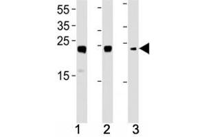 HMGB2 antibody western blot analysis in (1) HL-60, (2) K562, (3) H-4-II-E lysate. (HMGB2 anticorps  (AA 92-118))