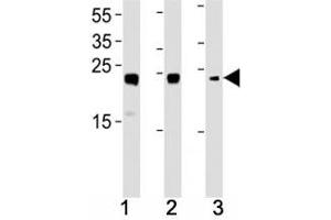 HMGB2 antibody western blot analysis in (1) HL-60, (2) K562, (3) H-4-II-E lysate. (HMGB2 anticorps  (AA 92-118))