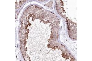 Immunohistochemical staining of human testis with IZUMO1 polyclonal antibody  shows strong cytoplasmic positivity in cells in seminiferus ducts.