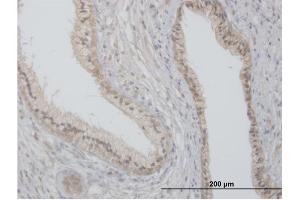 Immunoperoxidase of purified MaxPab antibody to FLOT2 on formalin-fixed paraffin-embedded human prostate. (Flotillin 2 anticorps  (AA 1-379))