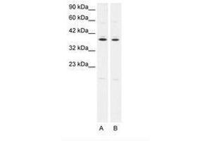 Image no. 1 for anti-Prostaglandin E Receptor 3 (Subtype EP3) (PTGER3) (C-Term) antibody (ABIN202406) (PTGER3 anticorps  (C-Term))