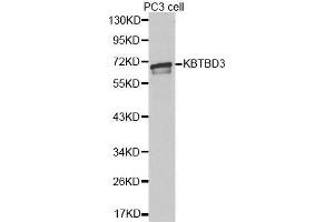 Western blot analysis of extracts of PC3 cell lines, using KBTBD3 antibody. (KBTBD3 anticorps  (AA 410-607))