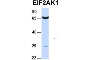 Host:  Rabbit  Target Name:  EIF2AK1  Sample Type:  Human 293T  Antibody Dilution:  1. (EIF2AK1 anticorps  (N-Term))