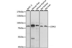 Western blot analysis of extracts of various cell lines using CEP63 Polyclonal Antibody at dilution of 1:1000. (CEP63 anticorps)
