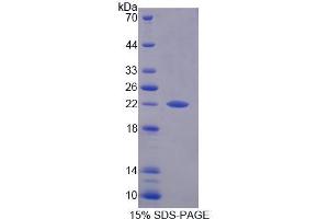 SDS-PAGE analysis of Human PFDN2 Protein.