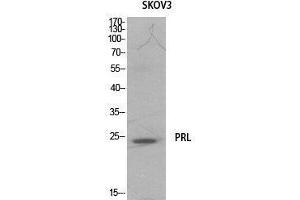 Western Blot (WB) analysis of SKOV3 cells using Prolactin Polyclonal Antibody. (Prolactin anticorps  (Internal Region))