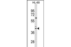 CCR4 Antibody (C-term) (ABIN1536966 and ABIN2849635) western blot analysis in HL-60 cell line lysates (35 μg/lane). (CCR4 anticorps  (C-Term))
