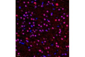Immunofluorescence of paraffin embedded rat brain using HOXC9 (ABIN7074251) at dilution of 1:650 (400x lens)