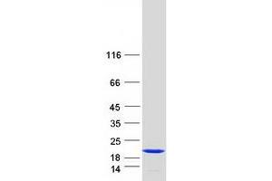Validation with Western Blot