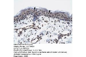 Human Skin (TAF9 anticorps  (N-Term))
