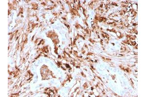 Formalin-fixed, paraffin-embedded human Pancreas stained with Ferritin, Light Chain Recombinant Mouse Monoclonal Antibody (rFTL/1388).