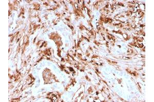 Formalin-fixed, paraffin-embedded human Pancreas stained with Ferritin, Light Chain Recombinant Mouse Monoclonal Antibody (rFTL/1388). (Recombinant FTL anticorps  (AA 38-165))