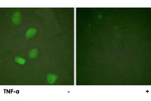 Immunofluorescence analysis of HeLa cells, treated with TNF-a (20 nM, 15 mins), using HDAC3 polyclonal antibody . (HDAC3 anticorps)