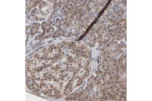 Immunohistochemical staining of human pancreas with MSL2 polyclonal antibody  shows cytoplasmic positivity in exocrine glandular cells and islet cells at 1:50-1:200 dilution.