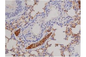 ABIN6267606 at 1/200 staining Mouse lung tissue sections by IHC-P.