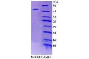SDS-PAGE (SDS) image for Microfibrillar Associated Protein 2 (MFAP2) (AA 8-171) protein (His tag,GST tag) (ABIN1981101)