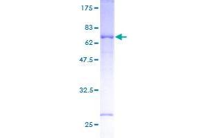 Image no. 2 for STE20-Related Kinase Adaptor beta (STRADB) (AA 1-418) protein (GST tag) (ABIN1321745)