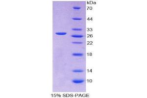 SDS-PAGE (SDS) image for Myogenin (Myogenic Factor 4) (MYOG) (AA 4-219) protein (His tag) (ABIN2125995) (Myogenin Protein (AA 4-219) (His tag))