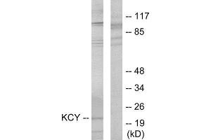 Western Blotting (WB) image for anti-KCY (N-Term) antibody (ABIN1849302) (KCY (N-Term) anticorps)