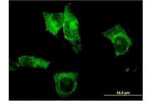 Immunofluorescence of monoclonal antibody to CEL on HeLa cell.