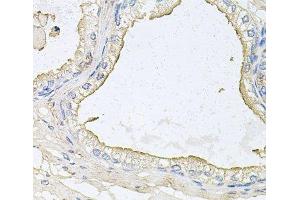 Immunohistochemistry of paraffin-embedded Human prostate using HPR Polyclonal Antibody at dilution of 1:100 (40x lens).