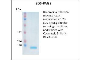 SDS-PAGE (SDS) image for Chemokine (C-C Motif) Ligand 5 (CCL5) (Active) protein (ABIN5509383)