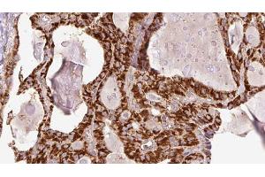 anti-WD Repeat Domain, Phosphoinositide Interacting 2 (WIPI2) (pSer413) antibody