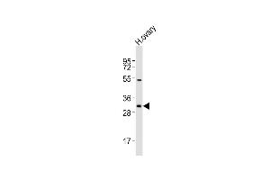 Anti-NBPF12 Antibody (Center)at 1:2000 dilution + human ovary lysates Lysates/proteins at 20 μg per lane. (NBPF12 anticorps  (AA 148-181))