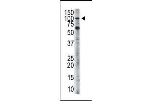 Image no. 1 for anti-Hexokinase 3 (White Cell) (HK3) (C-Term) antibody (ABIN360637)