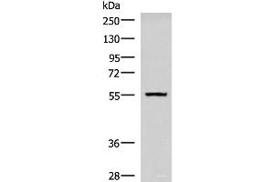 Western blot analysis of Human cerebella tissue lysate using CAMKK1 Polyclonal Antibody at dilution of 1:700 (CAMKK1 anticorps)
