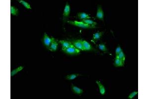 Immunofluorescence staining of Hela cells with ABIN7173439 at 1:133, counter-stained with DAPI. (TRIM35 anticorps  (AA 1-206))