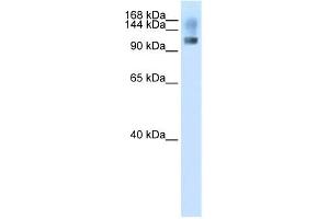 WB Suggested Anti-SFRS8 Antibody Titration:  2. (SFRS8 anticorps  (N-Term))