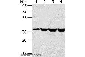 Western blot analysis of Human normal liver tissue and hepg2 cell, Jurkat and K562 cell, using HMOX2 Polyclonal Antibody at dilution of 1:550 (HMOX2 anticorps)