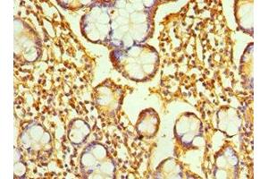 Immunohistochemistry of paraffin-embedded human small intestine tissue using ABIN7167346 at dilution of 1:100