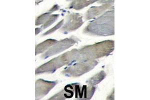 Formalin-fixed and paraffin-embedded human skeletal muscle tissue reacted with PIK3CG polyclonal antibody  , which was peroxidase-conjugated to the secondary antibody, followed by DAB staining. (PIK3 gamma anticorps  (Internal Region))