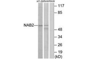 Western blot analysis of extracts from HT-29/RAW264. (NAB2 anticorps  (AA 261-310))