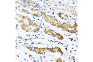 Immunohistochemistry of paraffin-embedded human stomach using OGN antibody (ABIN6131952, ABIN6145008, ABIN6145009 and ABIN6222384) at dilution of 1:100 (40x lens). (OGN anticorps  (AA 20-298))