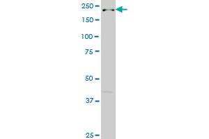 DOCK4 monoclonal antibody (M01), clone 3E7 Western Blot analysis of DOCK4 expression in Hela NE (DOCK4 anticorps  (AA 1867-1966))