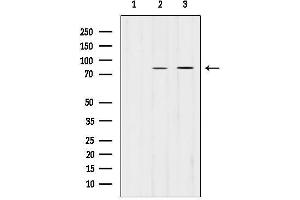 anti-Procollagen-Lysine 2-Oxoglutarate 5-Dioxygenase 2 (PLOD2) (C-Term) antibody