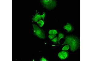 Immunofluorescent analysis of MCF-7 cells using ABIN7152544 at dilution of 1:100 and Alexa Fluor 488-congugated AffiniPure Goat Anti-Rabbit IgG(H+L)