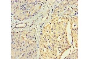 Immunohistochemistry of paraffin-embedded human pancreatic tissue using ABIN7174304 at dilution of 1:100 (USP3 anticorps  (C-Term))