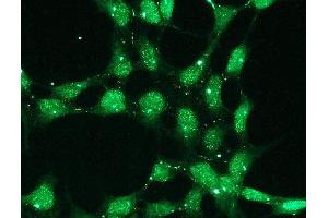 Immunofluorescence (IF) image for anti-Tumor Protein P53 (TP53) (C-Term) antibody (ABIN870298) (p53 anticorps  (C-Term))