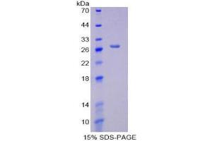SDS-PAGE (SDS) image for Creatine Kinase, Mitochondrial 1A (CKMT1A) (AA 41-250) protein (His tag) (ABIN1879599)