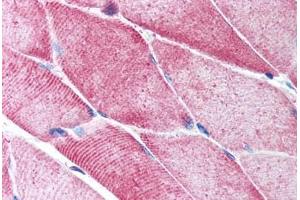 Human Skeletal Muscle (formalin-fixed, paraffin-embedded) stained with ACTA2 antibody ABIN213651 at 5 ug/ml followed by biotinylated goat anti-rabbit IgG secondary antibody ABIN481713, alkaline phosphatase-streptavidin and chromogen. (Smooth Muscle Actin anticorps  (N-Term))